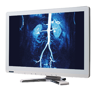 24" Medical Surgical Monitor, FHD touchscreen display with 900 Nits